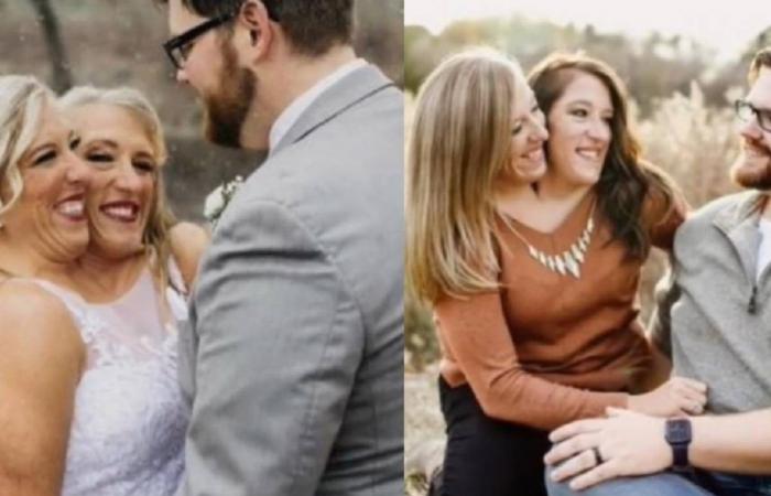 D’étranges jumeaux siamois se marient : la vidéo devient virale