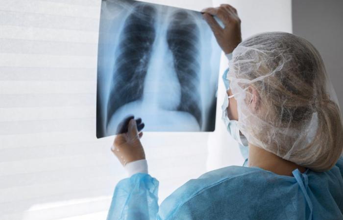 Cancer du poumon avancé, un traitement ciblé réduit le risque de décès