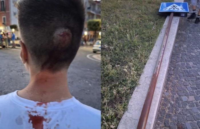 Pozzuoli choc, blessé à la tête par un poteau de signalisation alors qu’il marchait dans la Via Napoli