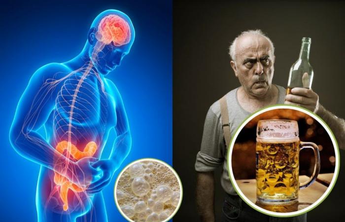 Cette maladie rare vous enivre sans boire : le cas mystérieux du syndrome de fermentation intestinale (SPA)