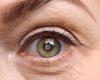 La cataracte, qu’est-ce que c’est, comment la traiter et quand se faire opérer – QuiFinanza