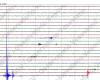 Tremblement de terre dans les Campi Flegrei, encore aujourd’hui un essaim sismique