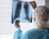 Cancer du poumon avancé, un traitement ciblé réduit le risque de décès