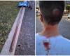 Un poteau de signalisation se détache et frappe un enfant à la tête, proche d’une tragédie à Pozzuoli