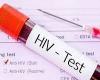 ICAR – VIH, nombre record de nouveaux diagnostics dans la Latium, tandis que Milan réduit les cas
